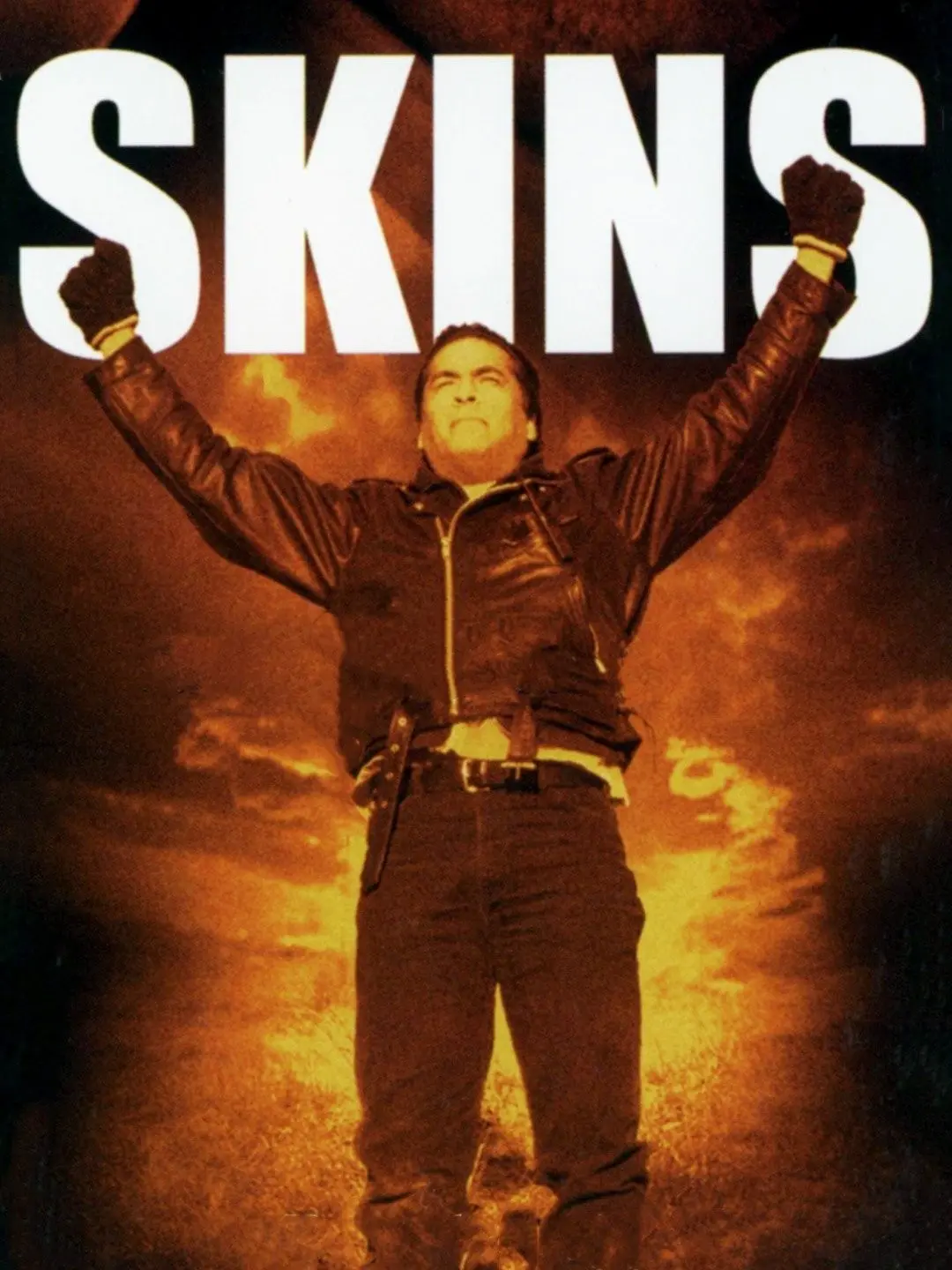 Skins (2002) 