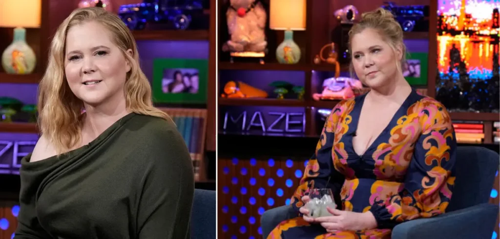 Amy Schumer Face Is Puffier