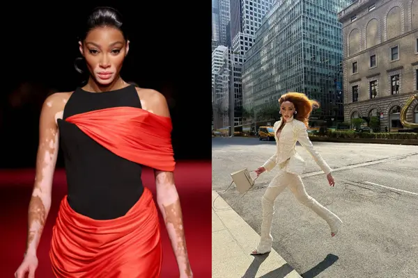 Winnie Harlow Early Life 