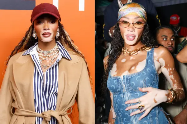 Winnie Harlow Social Media